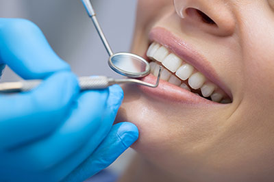 A dental hygienist cleaning a patient s teeth in a professional setting, with a focus on oral care.