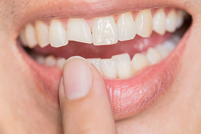 The image shows a close-up of a person s mouth with teeth, holding a finger near the teeth.