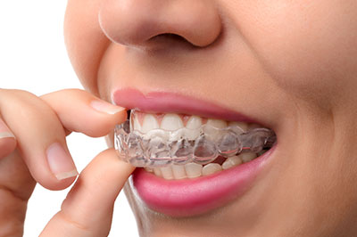 A woman with a toothy smile holding a clear, plastic dental aligner to her teeth.