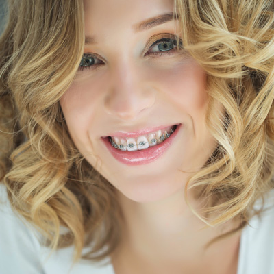 A woman with braces smiles at the camera, showcasing her orthodontic treatment.