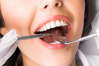 A woman in a dental office, smiling broadly with her mouth open as she receives dental treatment, with dental instruments visible.