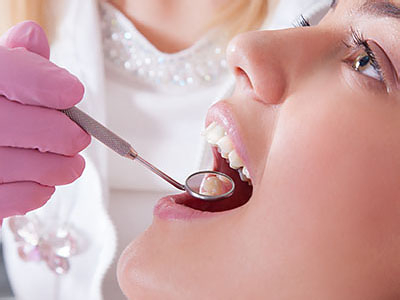 Woman receiving dental treatment, with a dentist using a drill on her teeth.