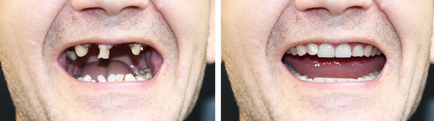 Coldwater Family Dentistry P.C. | Implant Dentistry, Pediatric Dentistry and Night Guards